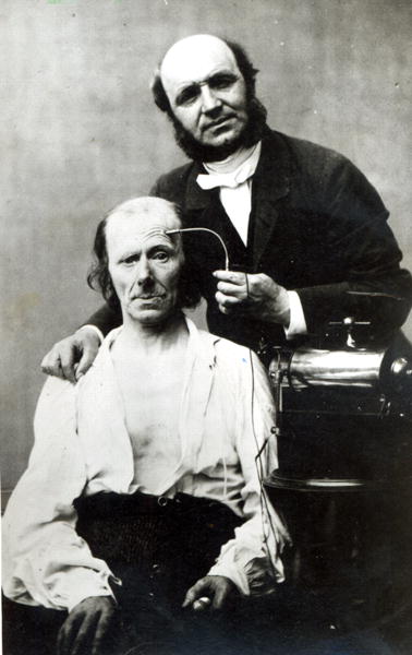 Duchenne de Boulogne with a ''victim patient'', 1862 (b/w photo)  von French Photographer