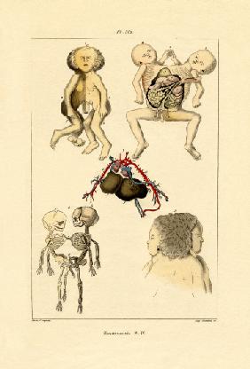 Freak 1833-39