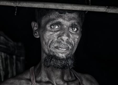 Rohingya-Flüchtling – Bangladesch