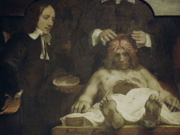 Rembrandt, Anatomie des Dr.J.Deijman von Rembrandt van Rijn